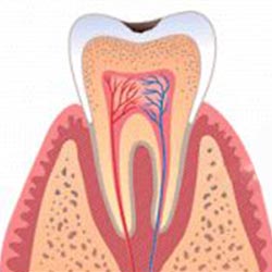 cavity-1 cavity-1