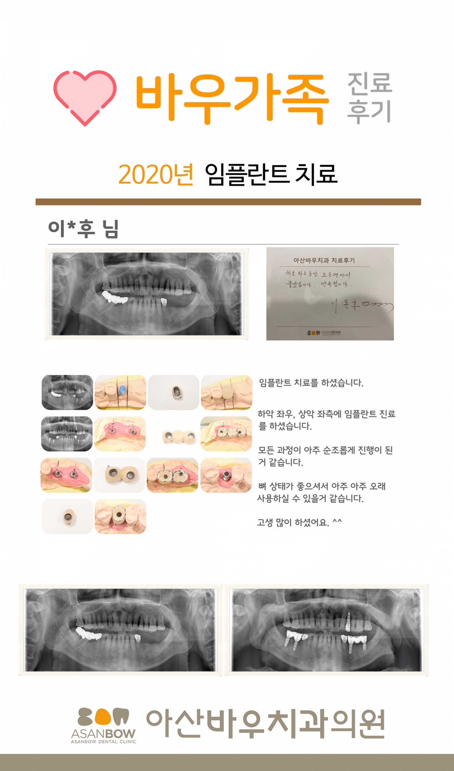 20120년-진료후기-이돈후